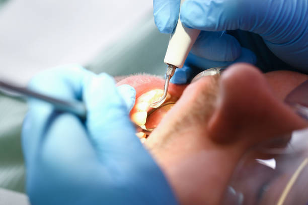 Best Emergency Dental Care for Trauma or Injury in Lucasville, OH